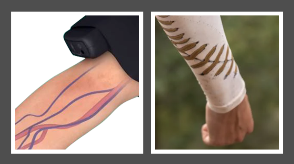 Fist Assist Arm Compression Massager vs Arm Compression Sleeve